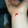 accident_1